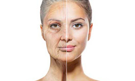 ساب سیژن و پی آر پی